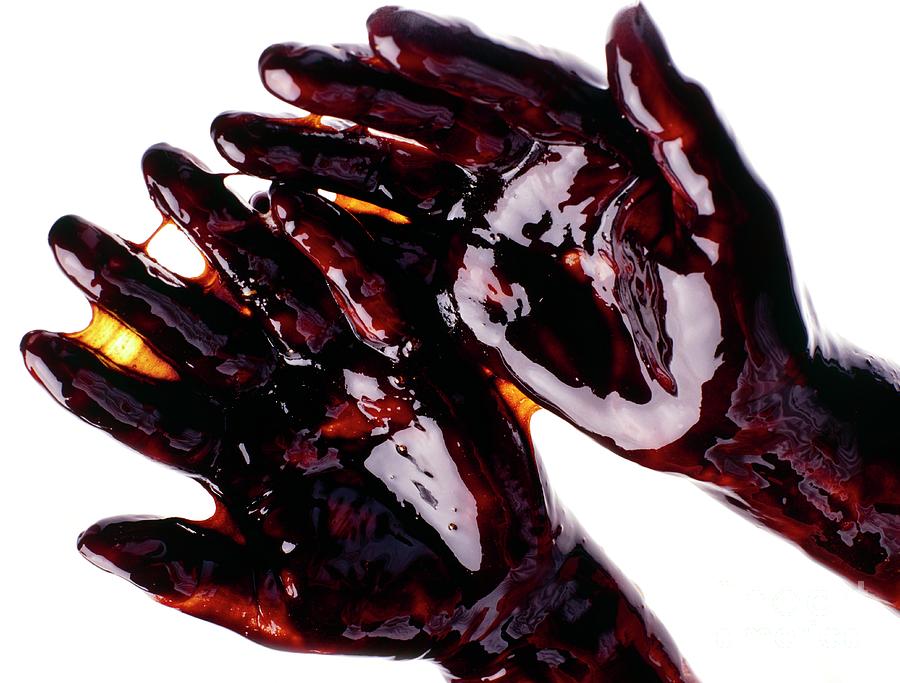 Womans Hands Coated In Syrup Photograph by Oscar Burriel/science Photo Library