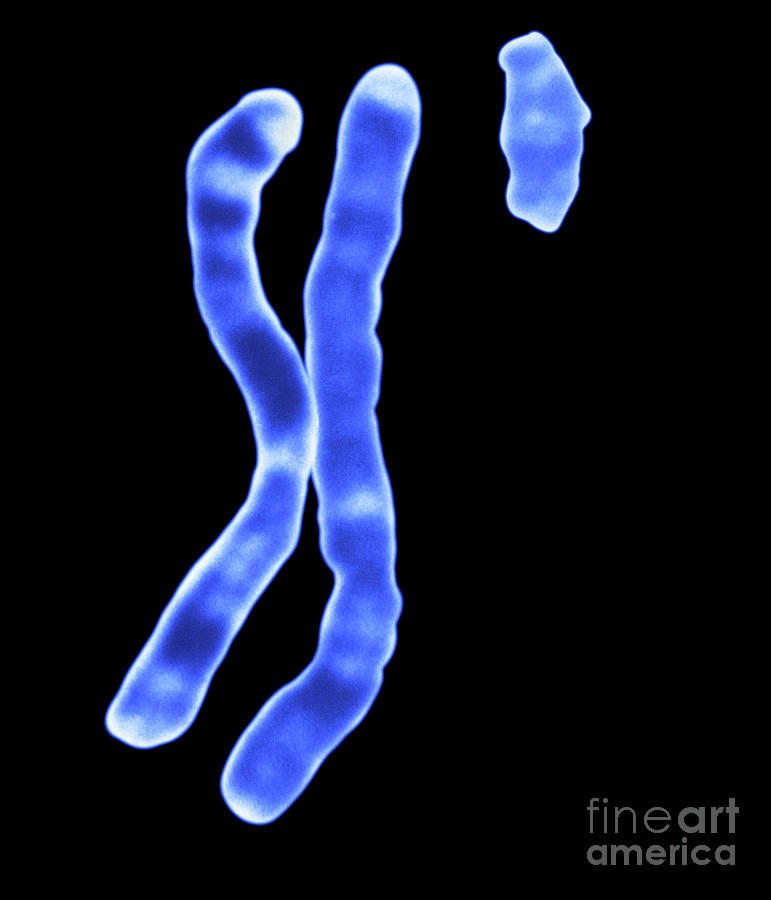 X And Y Chromosomes Photograph By Dept Of Clinical Cytogenetics Addenbrookes Hospitalscience 