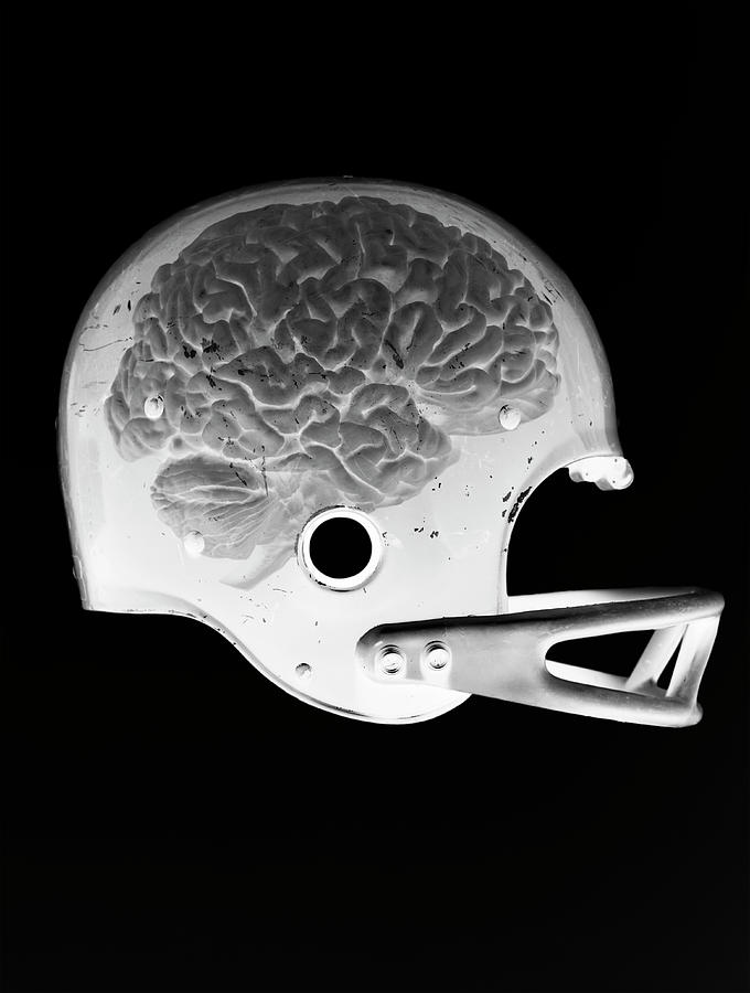 X-ray Image Of A Brain In A Football Photograph by Chris Parsons X-ray Image Of A Brain In A Football Photograph by Chris Parsons