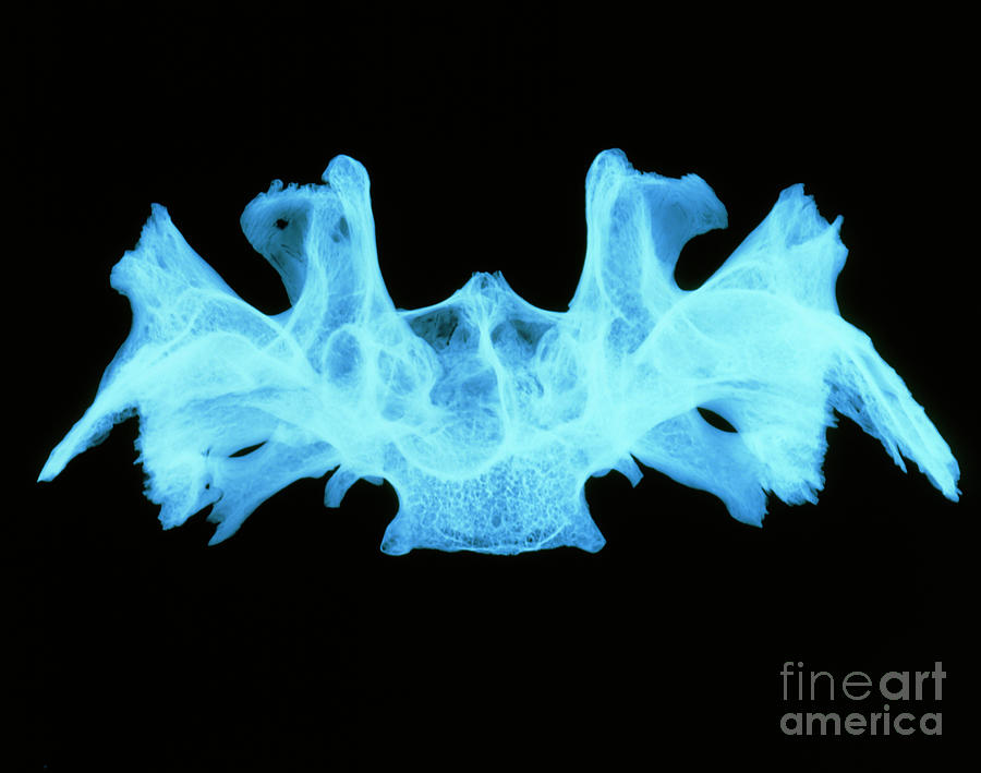 X-ray Image Of A Human Sphenoid Bone Photograph by D. Roberts/science Photo Library