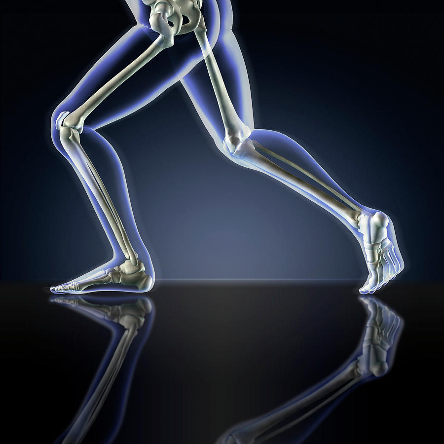 X-ray Of Running Leg Bones Photograph by Stocktrek