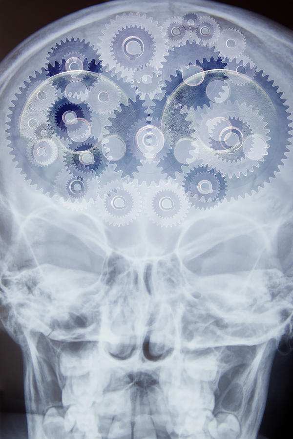 X-ray Of Skull With Cogs As Brain, Digital Montage Digital Art by Reb ...