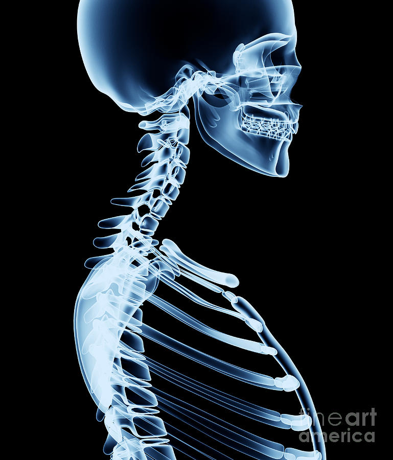 Chest Digital Art - X-ray Skeleton RÃÂ¶ntgen On Black by Posteriori