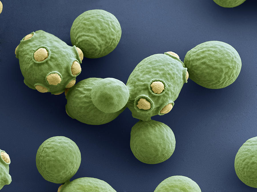 Yeast Cells Sem Photograph by Oliver Meckes EYE OF SCIENCE