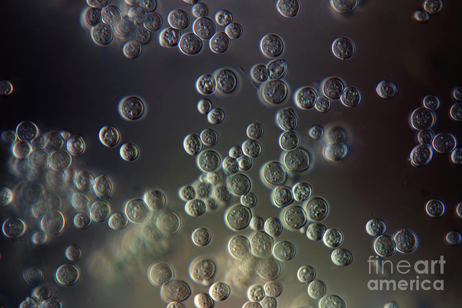 Yeast Photograph by Marek Mis/science Photo Library - Fine Art America