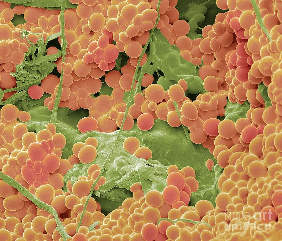 Yeast Photograph by Steve Gschmeissner/science Photo Library - Pixels