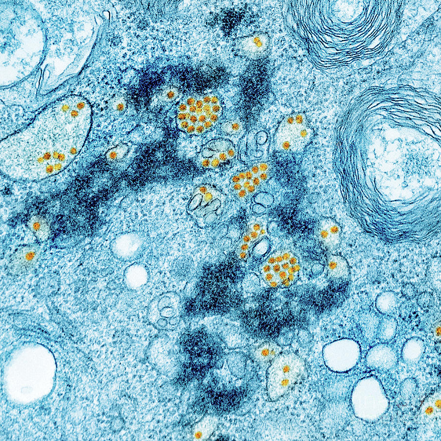 Yellow Fever Virus Photograph by Niaid/national Institutes Of Health