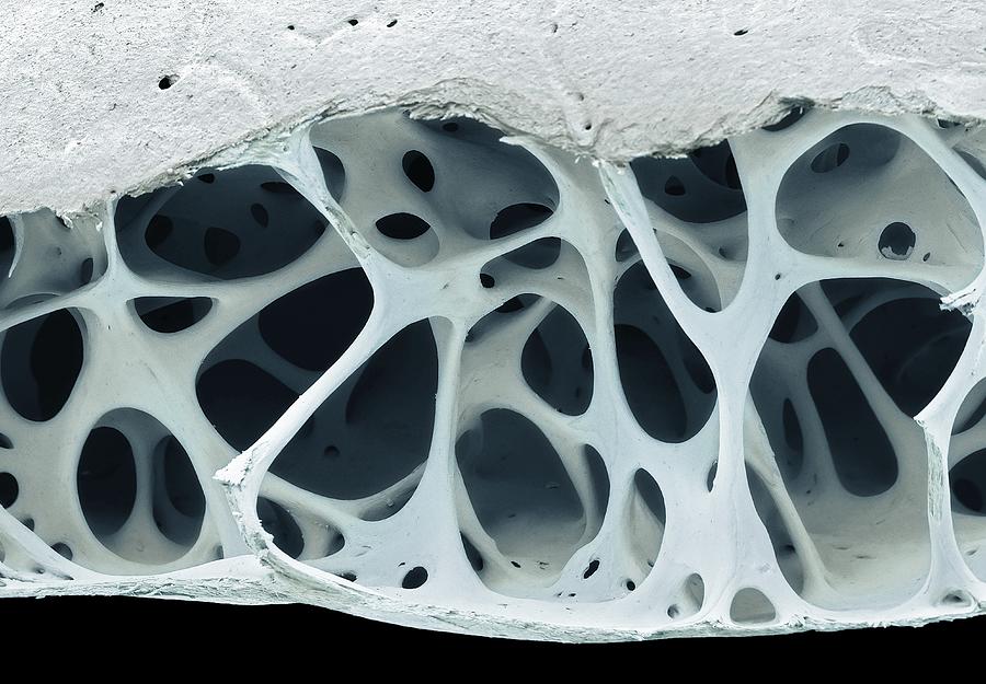 Bird bone tissue, SEM #1 Drawing by Steve Gschmeissner/science Photo Library