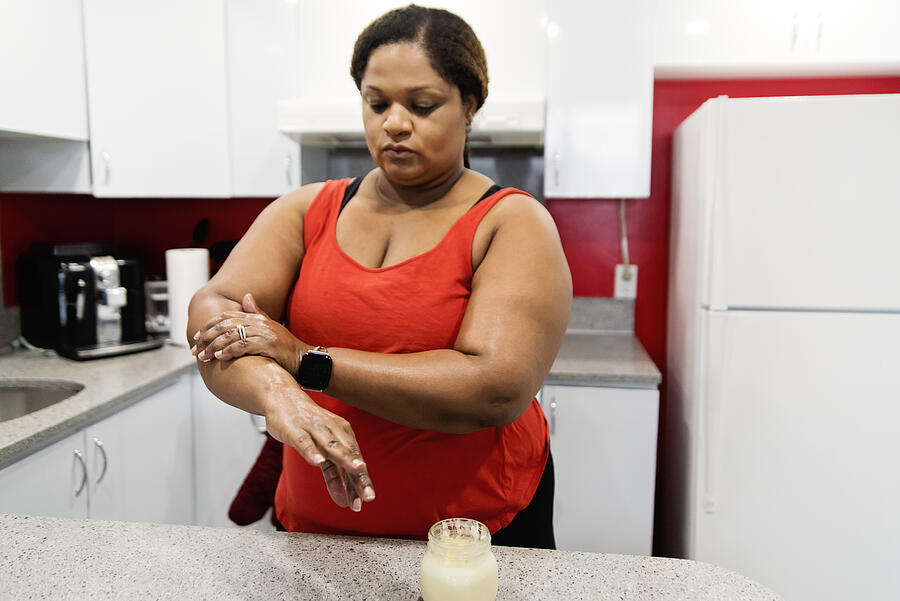 Body positive woman rubbing on homemade hand cream. #1 Photograph by Martinedoucet