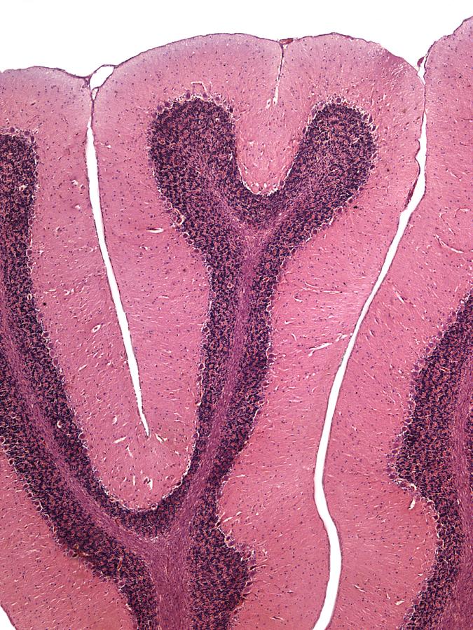 Cerebellum, light micrograph #1 Photograph by Steve Gschmeissner