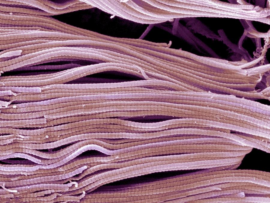 Collagen, Scanning electron micrograph (SEM) #1 Drawing by Science Photo Library - STEVE GSCHMEISSNER.