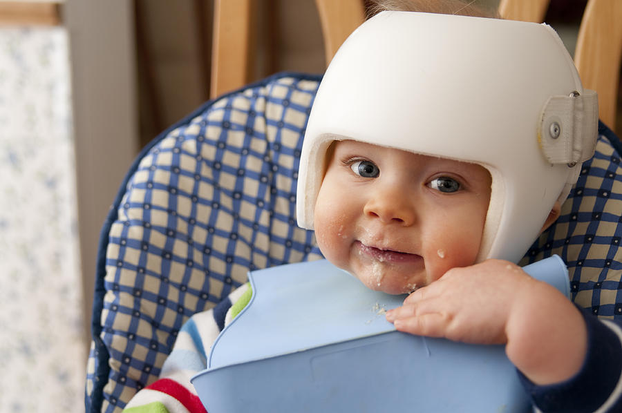 Cranial Remolding helmet worn for the treatment of plagiocephaly #1 Photograph by Box5