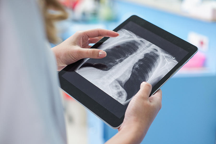 Doctors examining x-ray of chest and ribs on digital tablet #1 Photograph by Jackyenjoyphotography