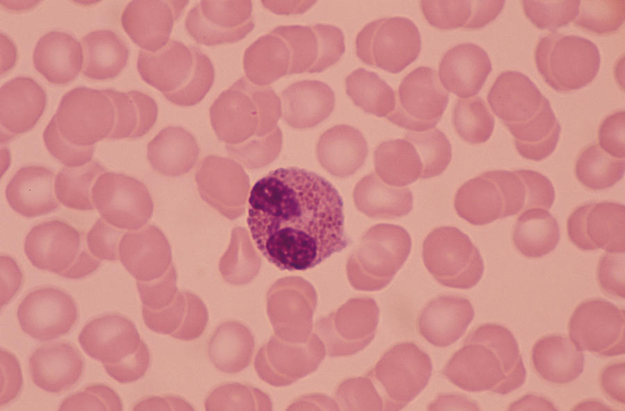 Eosinophil (wbc) Bilobed Nucleus & Reddish Cytoplas- Mic Granules. 400x #1 Photograph by Ed Reschke
