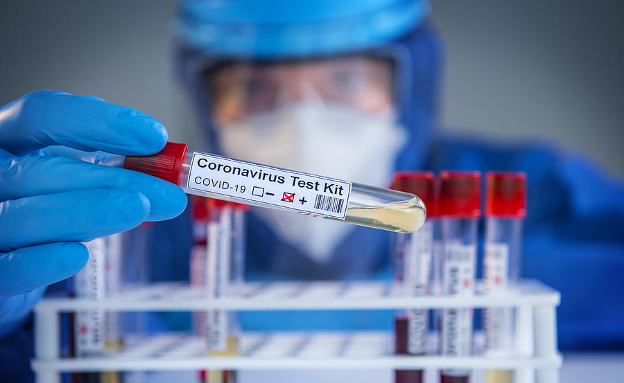 Examining coronavirus COVID 19 medical samples on kits novel corona virus outbreak Photograph by Hocus-focus