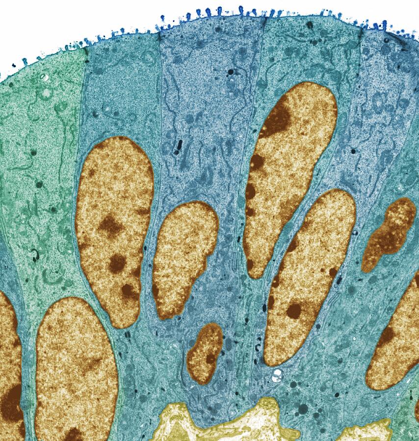 Fallopian tube, colored transmission electron micrograph (TEM) #1 Drawing by Steve Gschmeissner/spl Fallopian tube, colored transmission electron micrograph (TEM) #1 Drawing by Steve Gschmeissner/spl