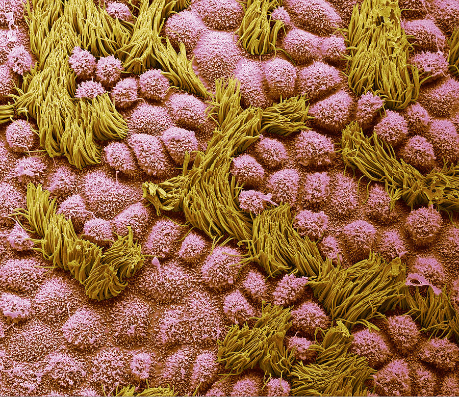 Fallopian tube, SEM #1 Photograph by Steve Gschmeissner/science Photo Library