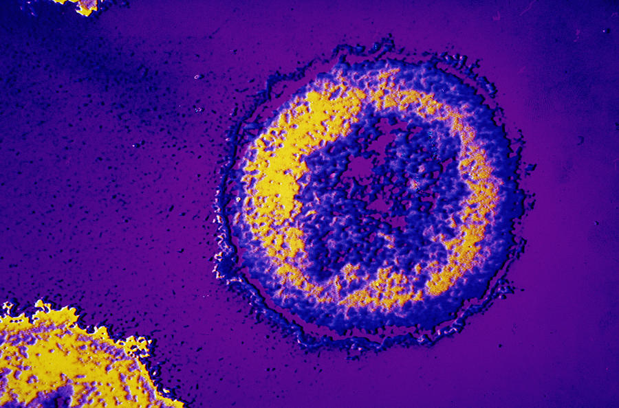 Microscopic HIV virus #1 Photograph by GeoStock