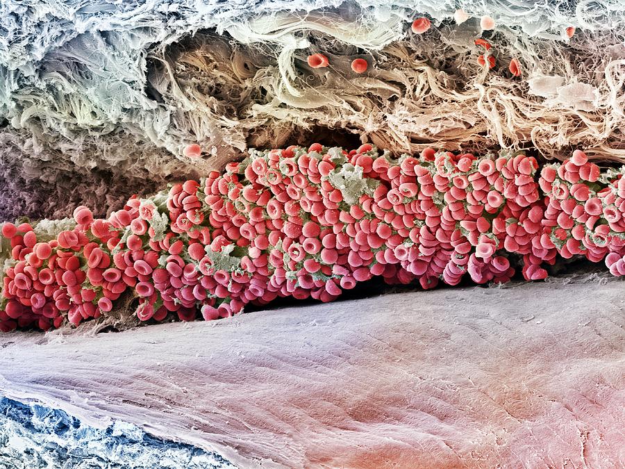 Scanning electron micrograph (SEM) of red blood cell #1 Photograph by Steve Gschmeissner/spl