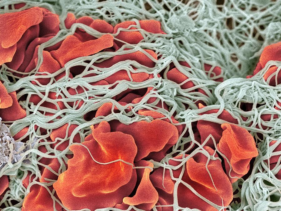 Scanning electron microscope (SEM) of red blood cell #1 Photograph by Science Photo Library - STEVE GSCHMEISSNER.