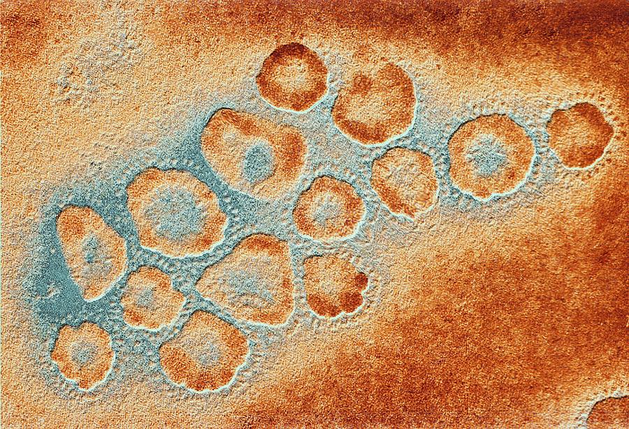 TEM of a cluster of corona viruses #1 Photograph by Pasieka