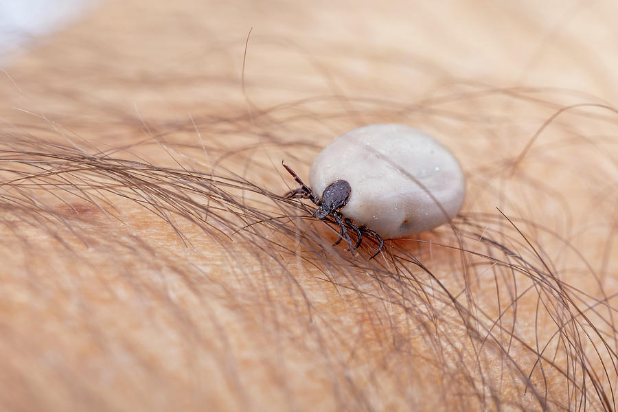 Tick on human hand Photograph by Artush Foto - Pixels