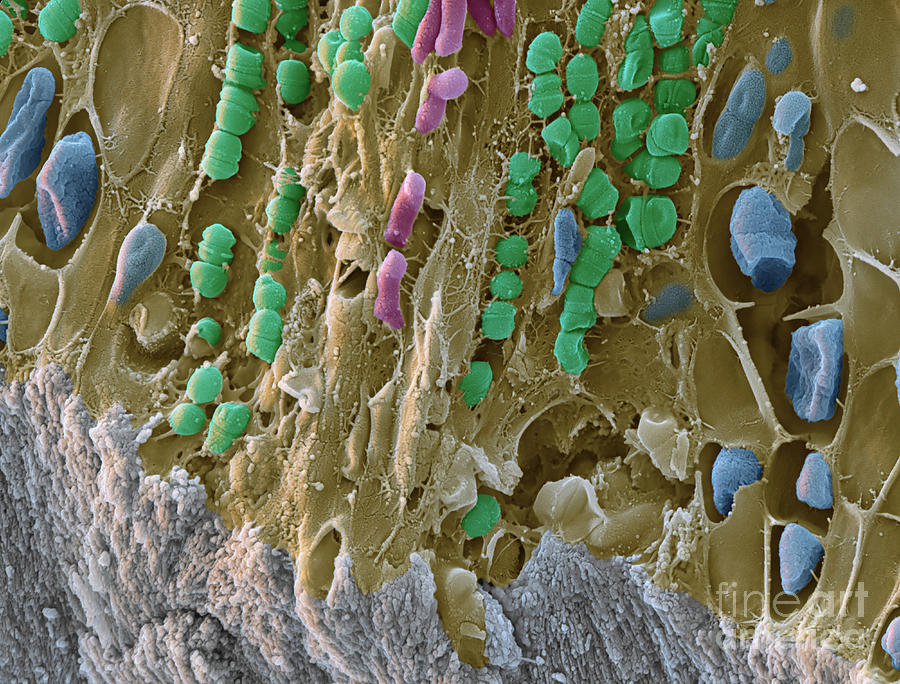 Tooth Plaque SEM #1 Photograph by Eye of Science