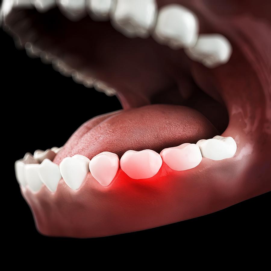 Toothache, conceptual artwork #1 Drawing by Sciepro