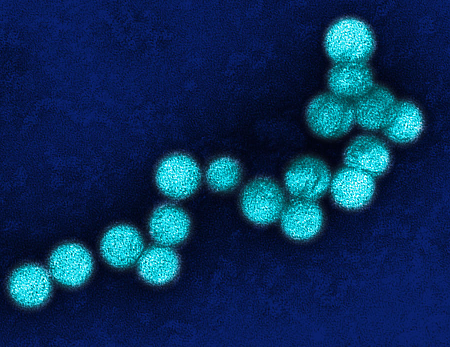 West nile virus #1 Photograph by Bsip