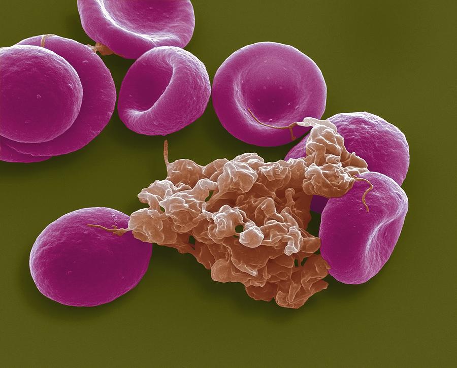 Physiology Photograph - Blood cells, SEM #12 by Steve Gschmeissner