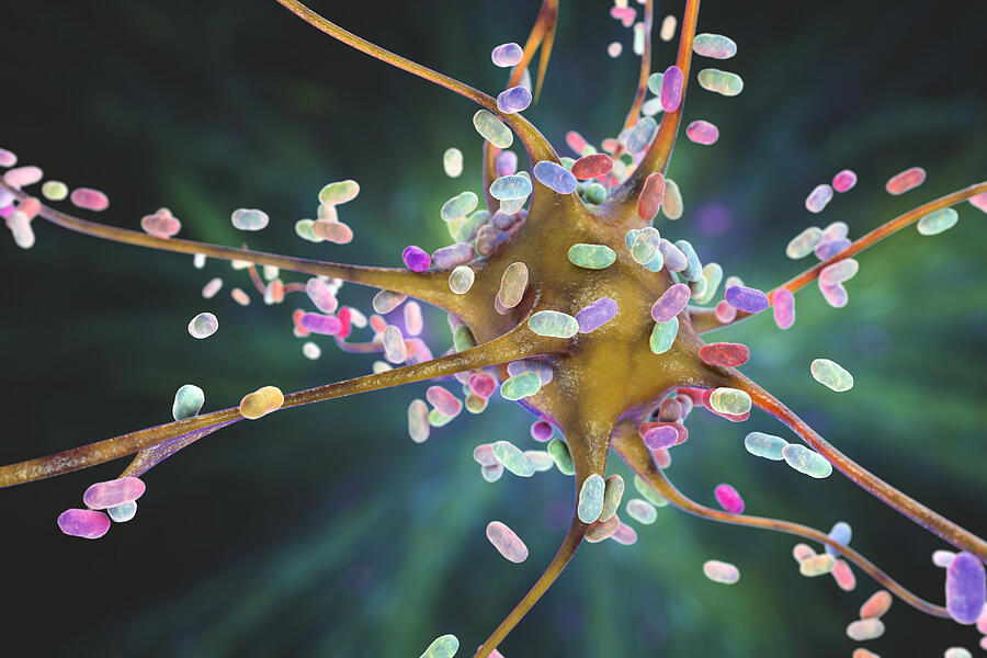 Bacterial encephalitis, illustration #18 Drawing by Kateryna Kon/science Photo Library Bacterial encephalitis, illustration #18 Drawing by Kateryna Kon/science Photo Library