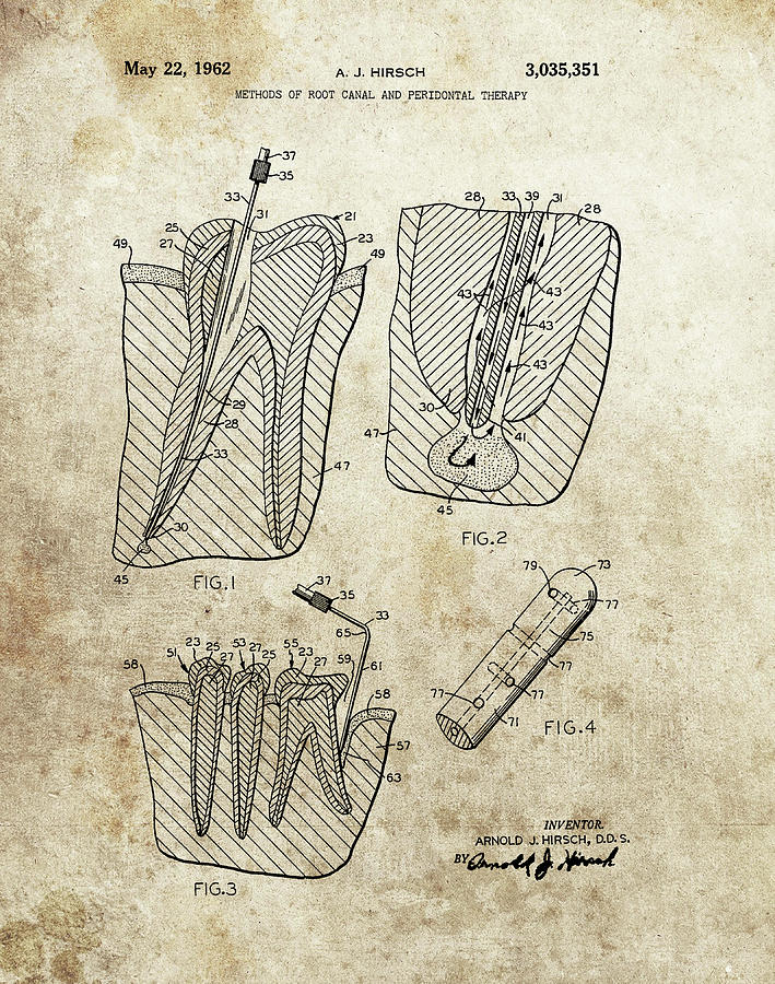 Root Canal Drawing - 1962 Root Canal Patent by Dan Sproul