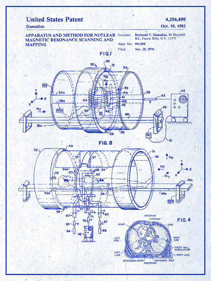 blueprint of inside mechanics of mri machine