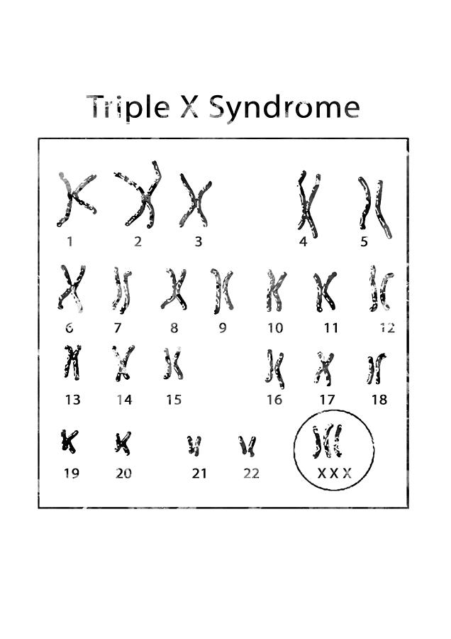 Triple X Syndrome Digital Art By Erzebet S