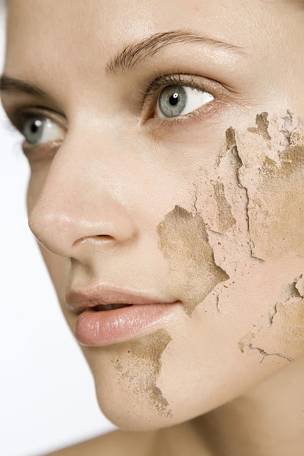 Woman with cracked and peeling skin #2 Photograph by Image Source