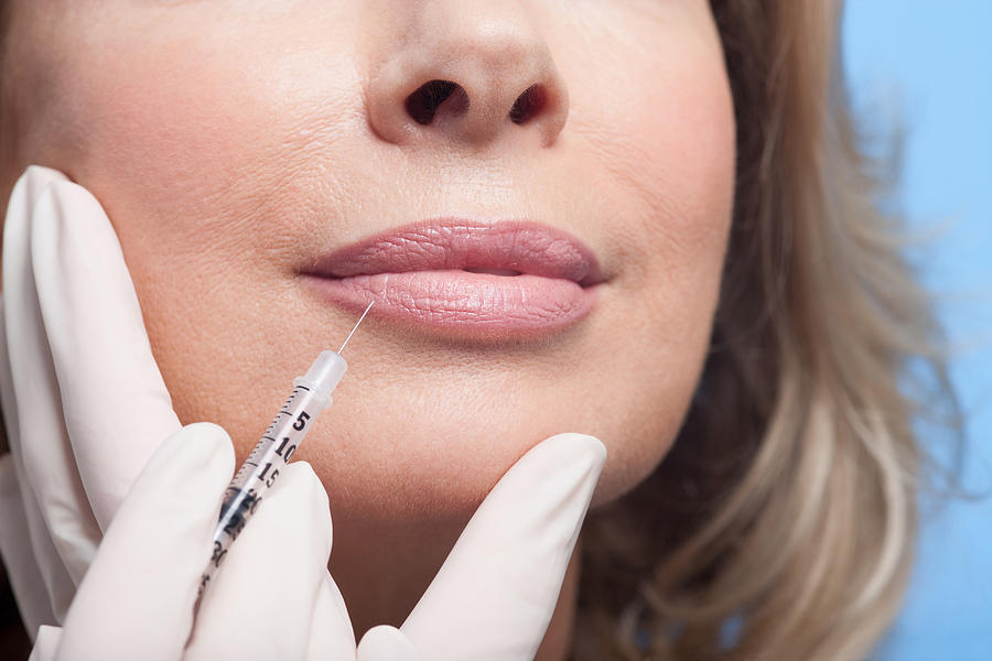 Close up of woman receiving botox injection in lips #3 Photograph by Robert Daly