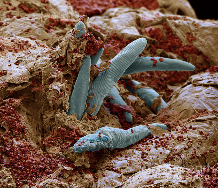 Demodex folliculorum #3 Photograph by Eye of Science