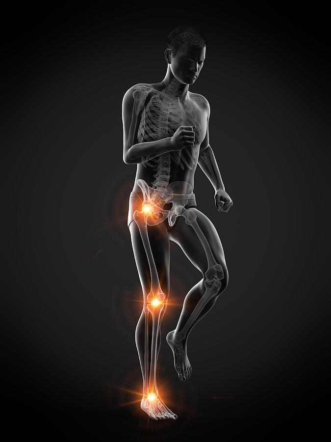 Joint pain, conceptual illustration #3 Drawing by Sebastian Kaulitzki/science Photo Library