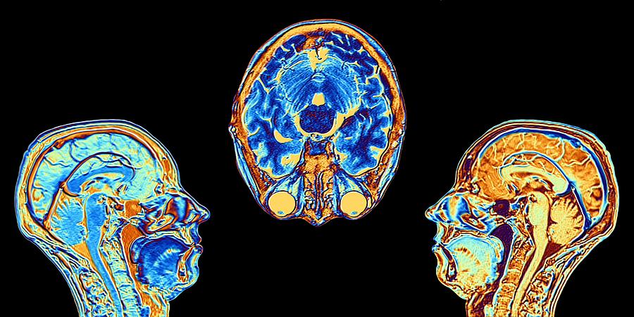 MRI scans of normal brains, illustration #3 Photograph by Alfred Pasieka/science Photo Library