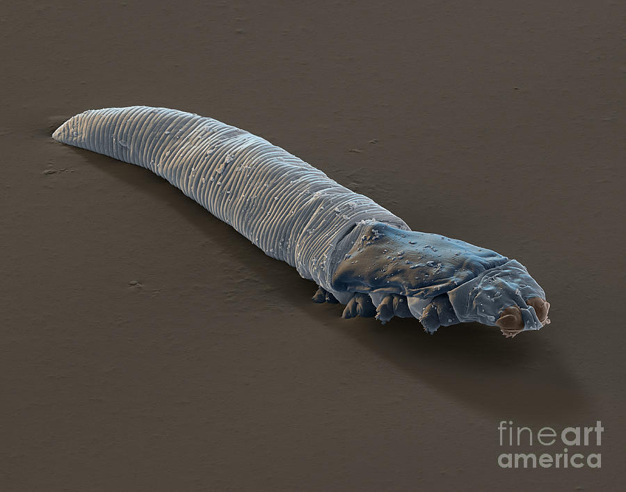 Demodex folliculorum #5 Photograph by Eye of Science