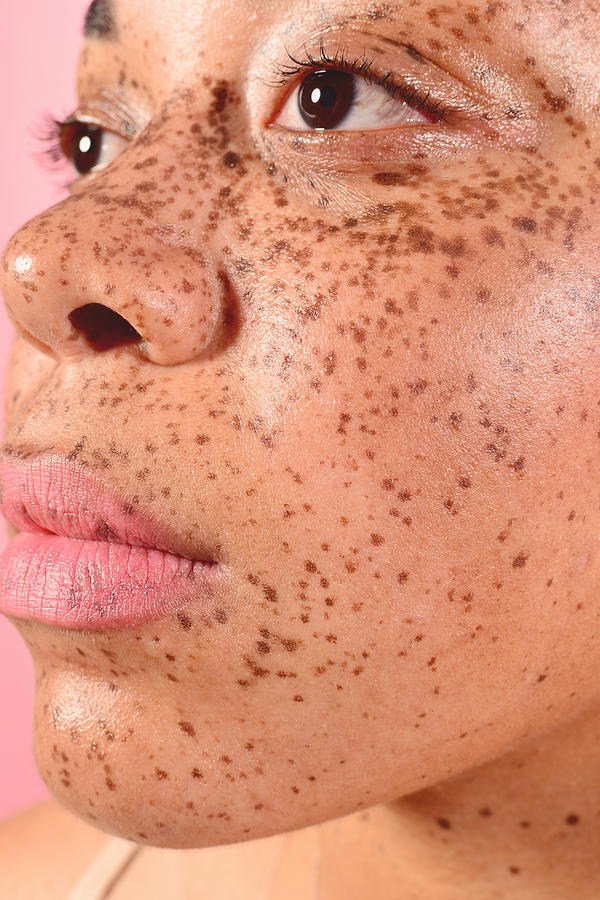 Beauty Portrait of Young Confident Woman with Freckles #6 Photograph by Rochelle Brock / Refinery29 for Getty Images