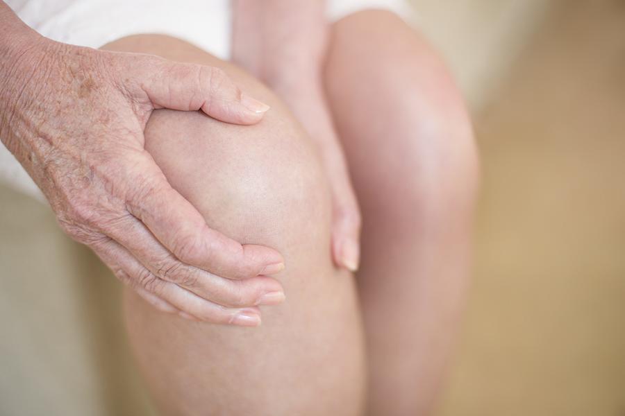 Woman with knee pain #7 Photograph by Science Photo Library