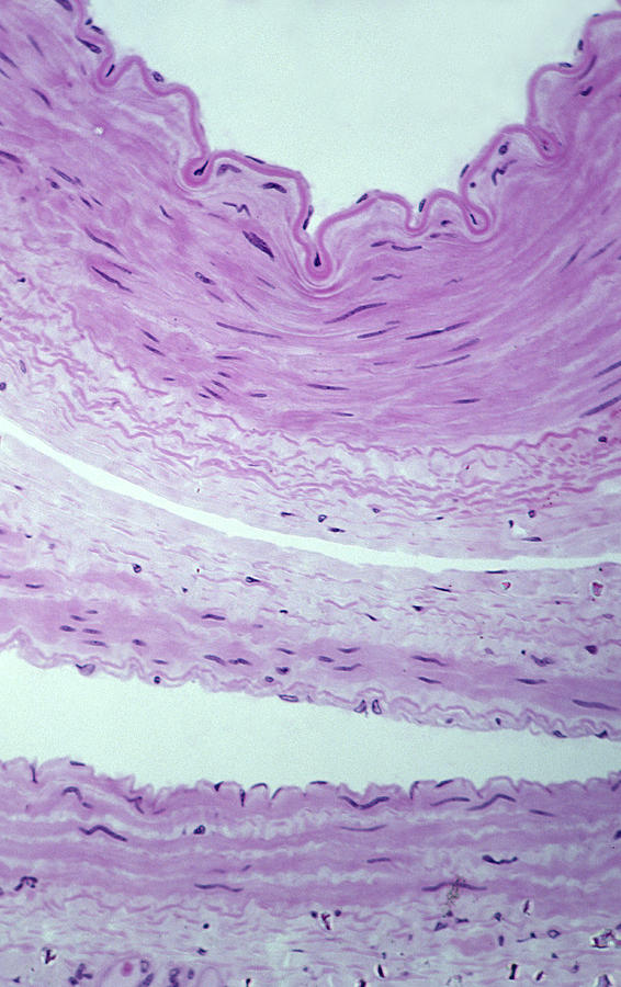 A comparison of an ARTERY and VEIN showing the TUNICS (or Layers) cross section, 50X Photograph by Ed Reschke