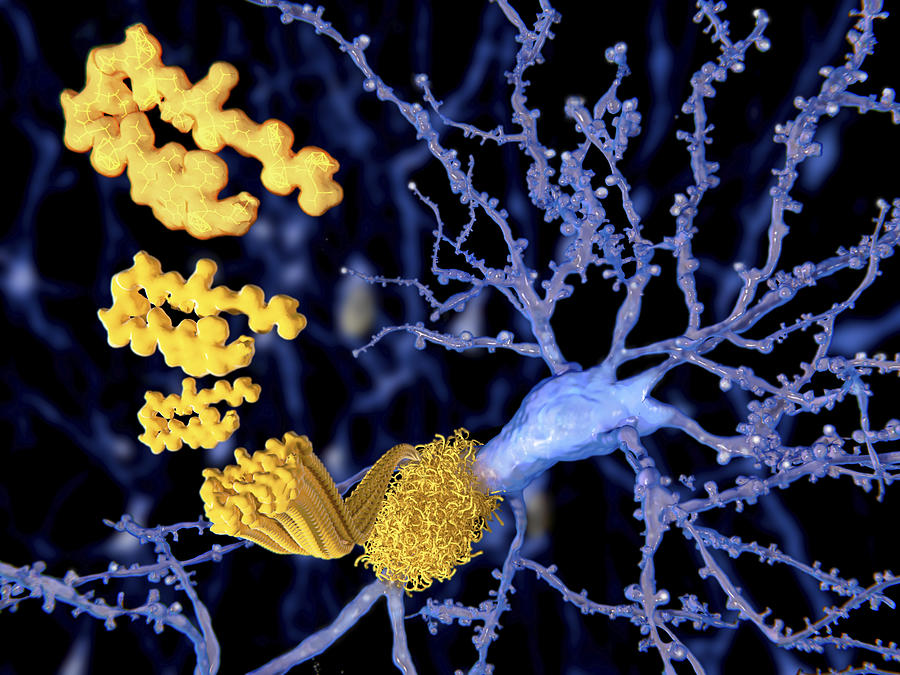 Amyloid beta peptide, illustration Drawing by Juan Gaertner/science Photo Library