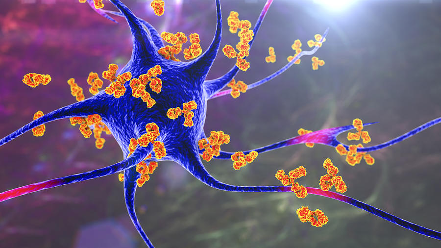 Antibodies attacking neurons, conceptual illustration Drawing by Kateryna Kon/science Photo Library