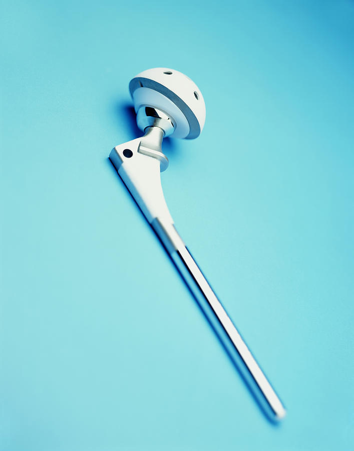 Artificial hip joint Photograph by Peter Dazeley