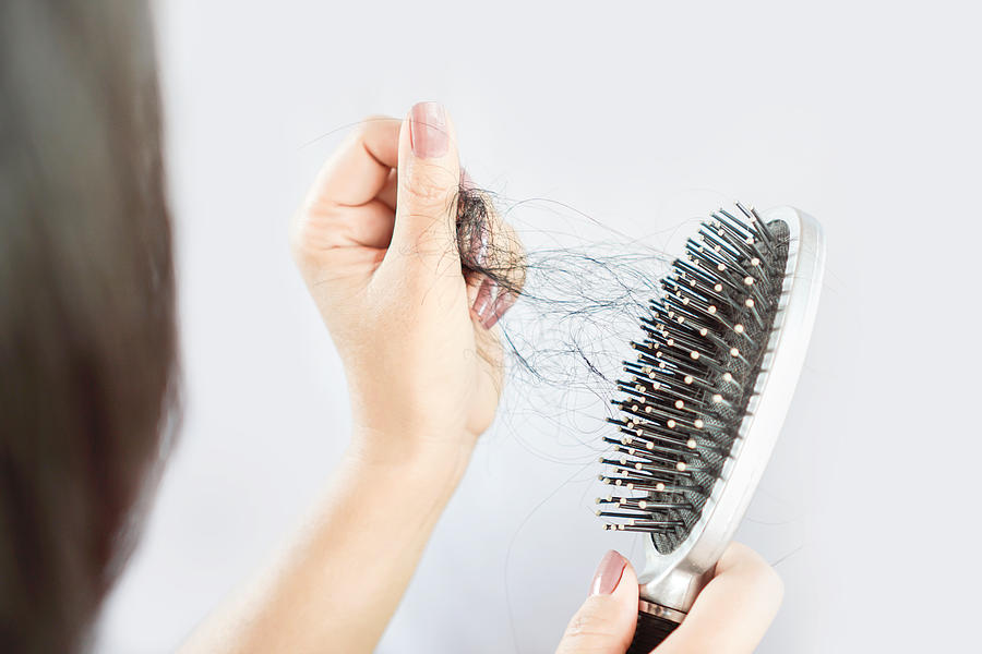Asian woman hand holding hair loss falling on comb Photograph by Doucefleur