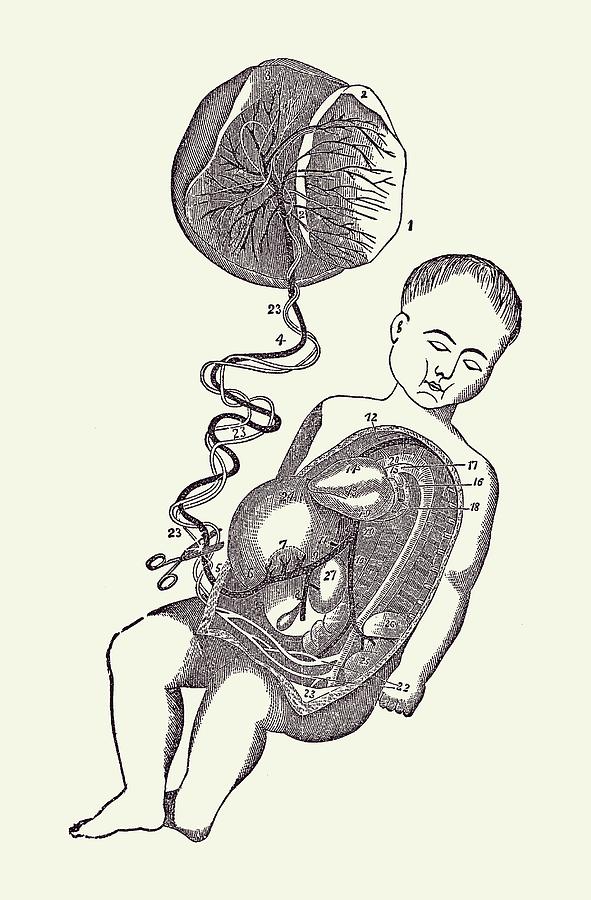 Baby and Placenta - Placenta Removal - Vintage Anatomy 2 Drawing by Vintage Anatomy Prints