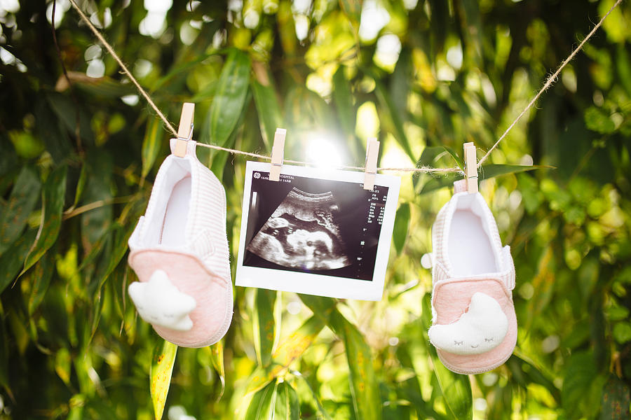 Babys Shoes And Ultrasound Image On Laundry Clothesline Photograph by Insung Jeon