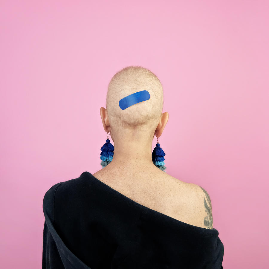 Back of womans bald head with bandage Photograph by Juj Winn